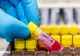 Analiza Bloomberg care arata cand va lua sfarsit pandemia de Coronavirus
